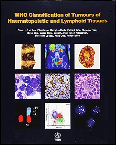 WHO Classification of Tumours of Haematopoietic and Lymphoid ...